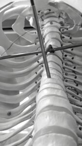 Intricate black and white photo of a human rib cage model with metal rods and wires